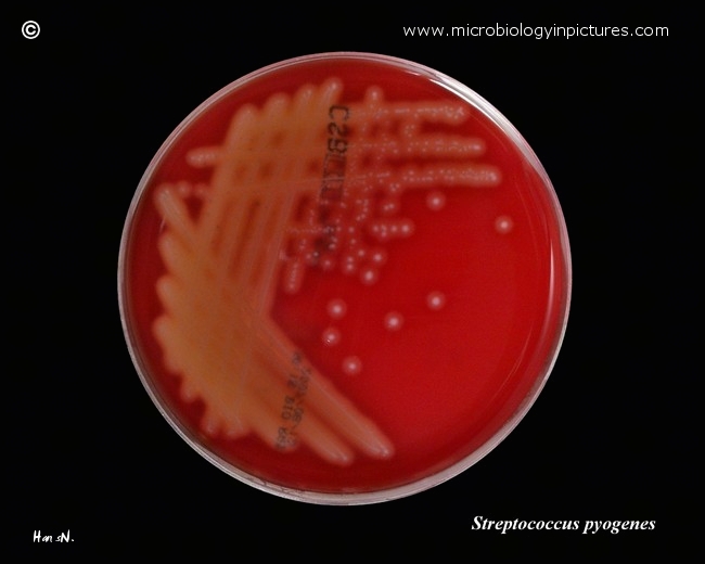 streptococcus pyogenes colonies on agar plate